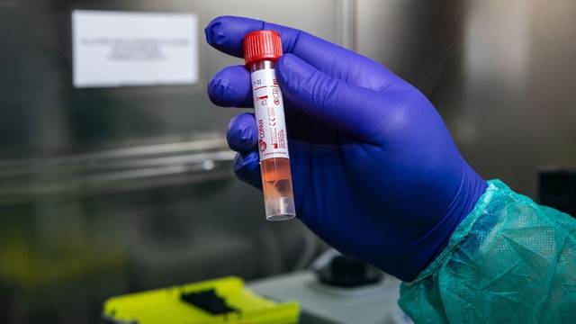 Saudi Arabia registers 2,795 coronavirus cases to date