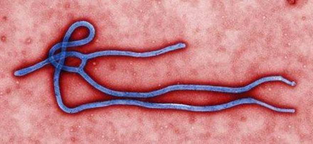  آلاف الأطفال تيتموا بسبب إيبولا