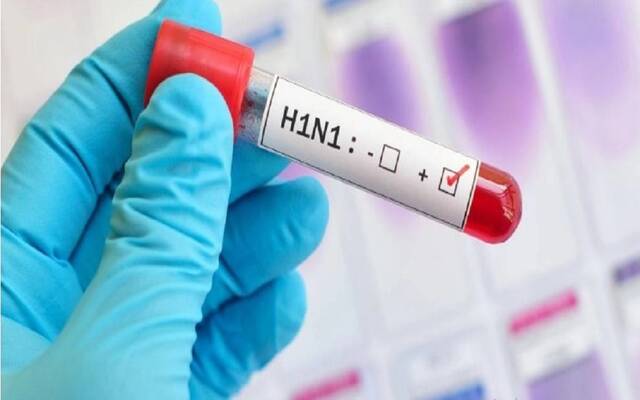 طفلة عمرها 3 سنوات.. المكسيك تسجل أول إصابة بشرية مؤكدة بإنفلونزا الطيور