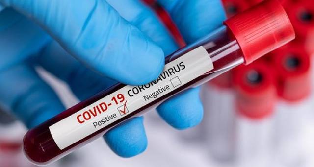 Kuwait announces 109 new coronavirus cases; tally at 665