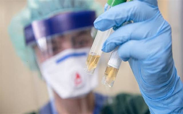 الإمارات تُعلن عن حالة إصابة جديدة بفيروس كورونا