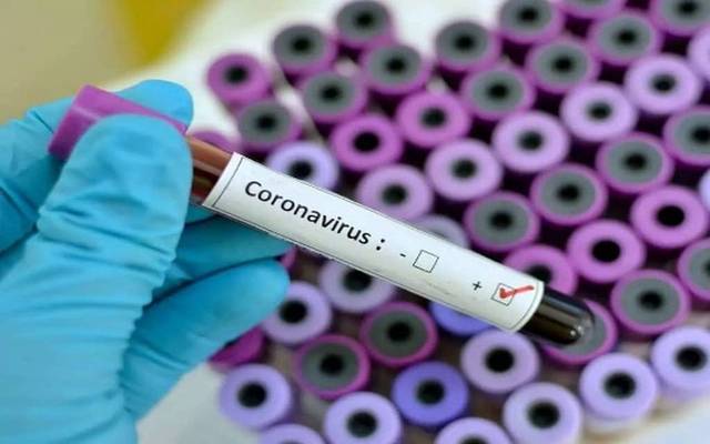 "الصحة العالمية": أكثر من 20 لقاحاً متعلقاً بفيروس "كورونا" قيد التطوير