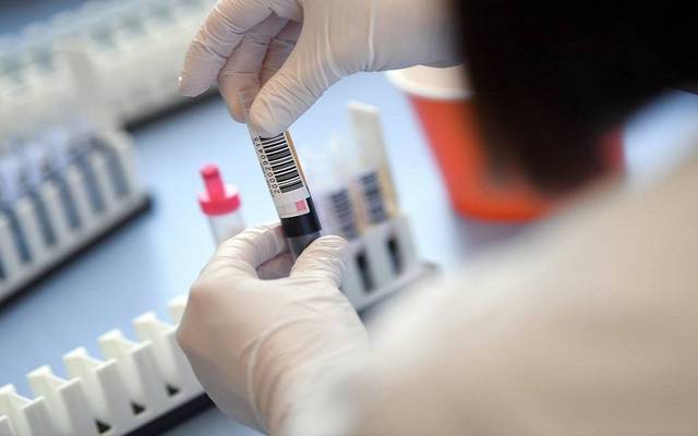 التشخيص المتكاملة تعلن بدء توزيع الأرباح النقدية بواقع 2.17 جنيه للسهم