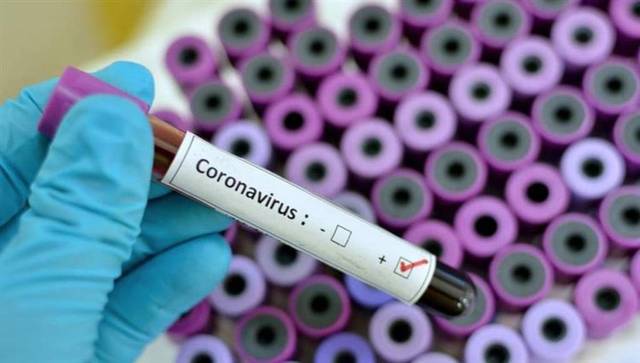 Egypt’s COVID-19 cases exceed 10K