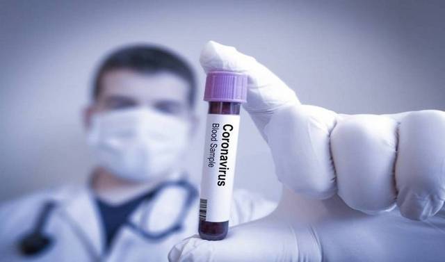 مصر تسجل 88 حالة وفاة و1218 إصابة جديدة بفيروس كورونا.. الخميس