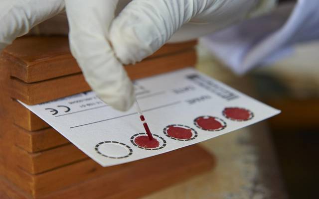 السعودية تُلزم وافدي الدول الموبوءة بكورونا بإجراء فحص "PCR" لاستقبالهم